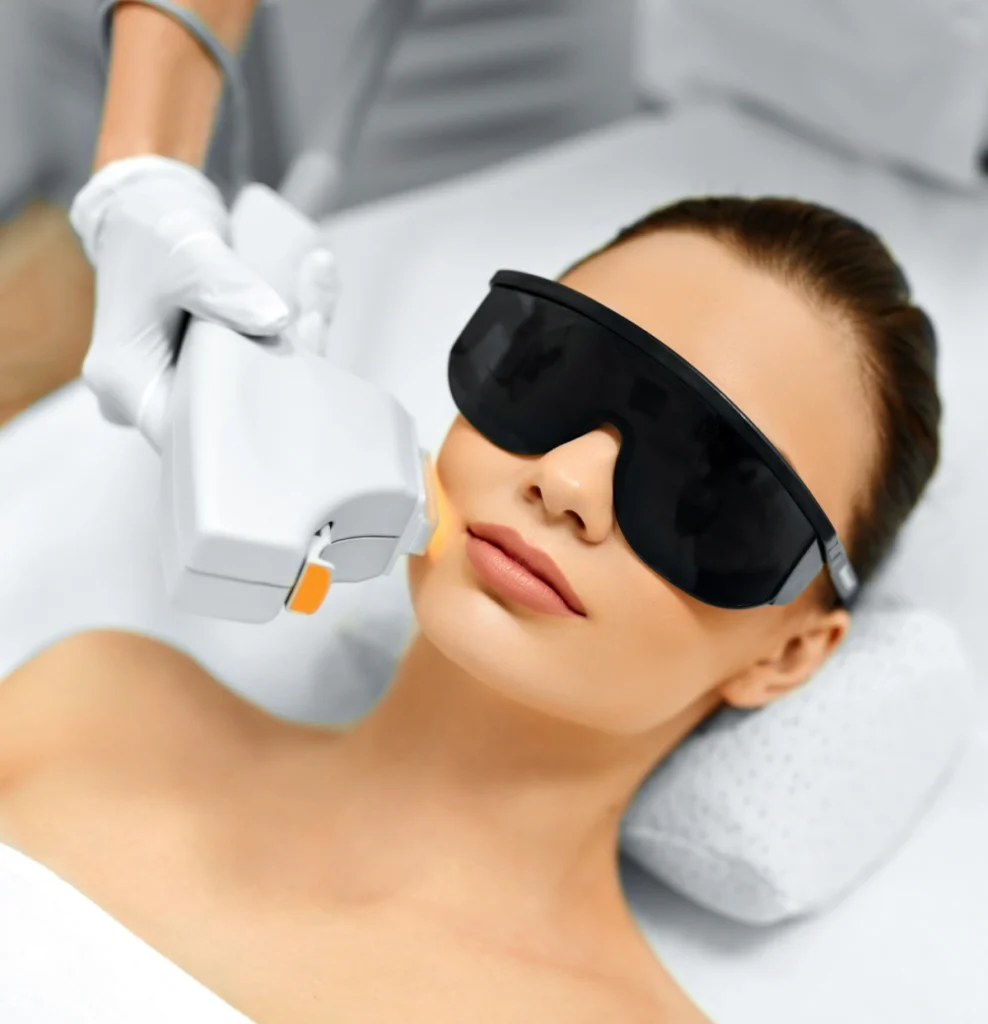 IPL Photo Facial in Sarasota - Elite Medical Spa