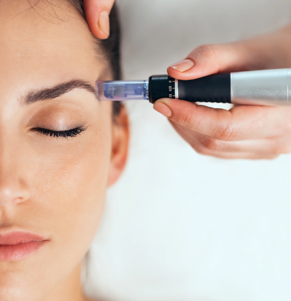 Microneedling Treatment at Elite Medical Spa Sarasota