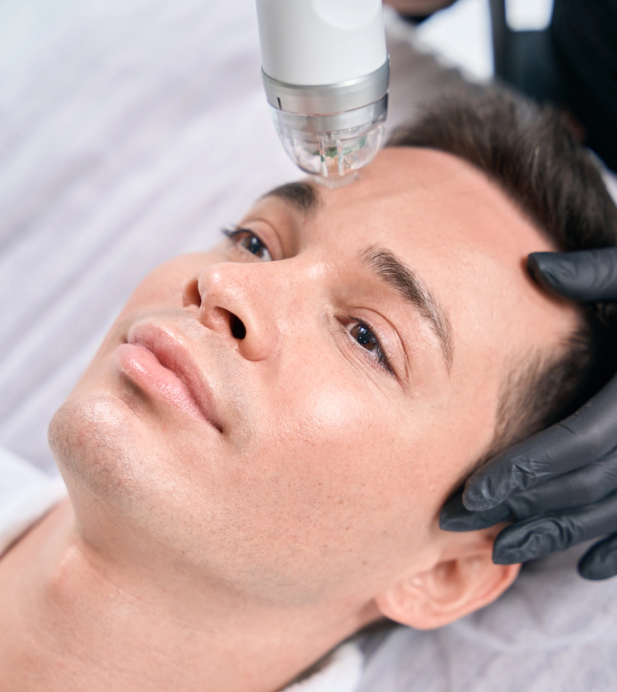 Exactly How Does Microneedling Work - Elite Medical Spa