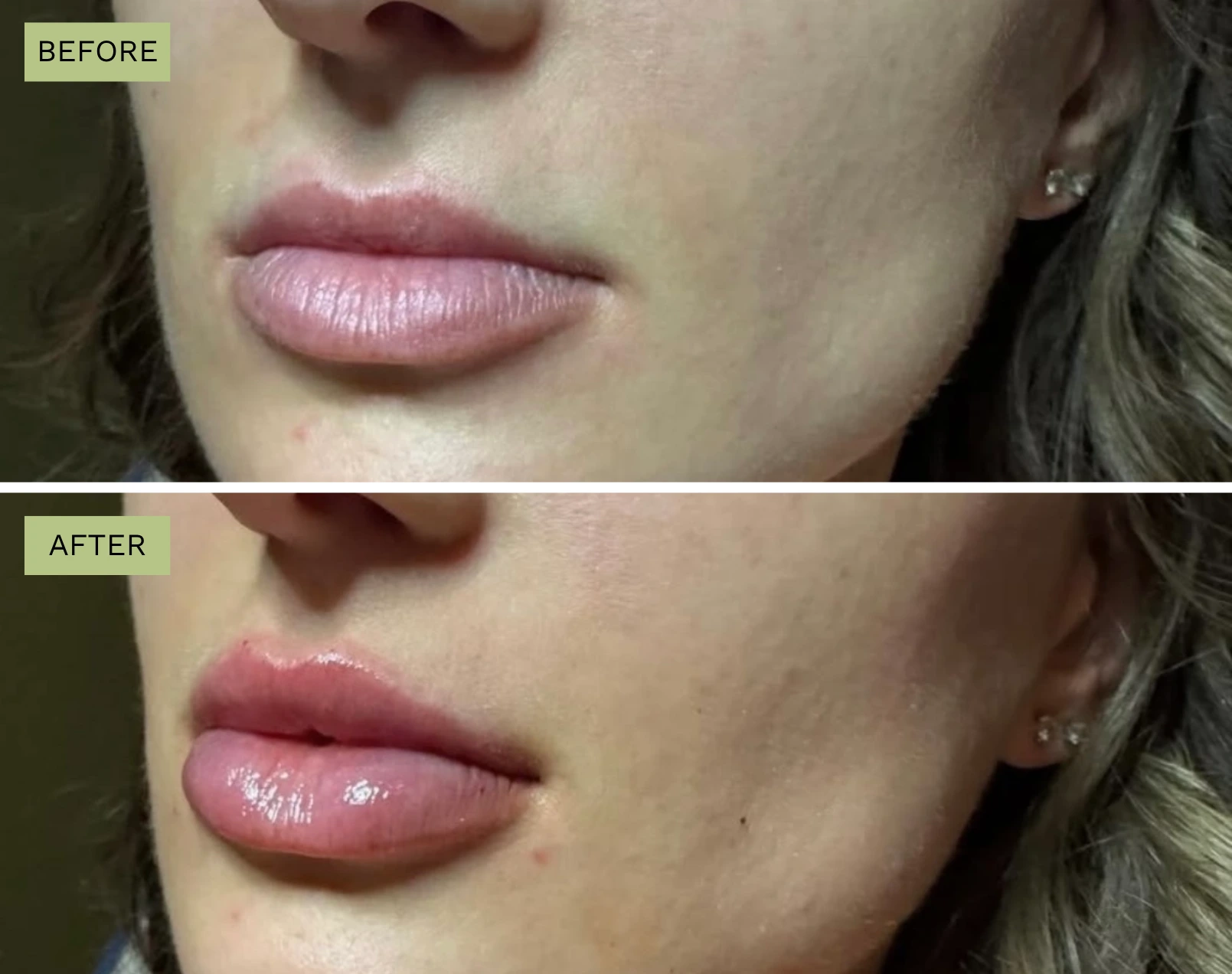 Elite Lips