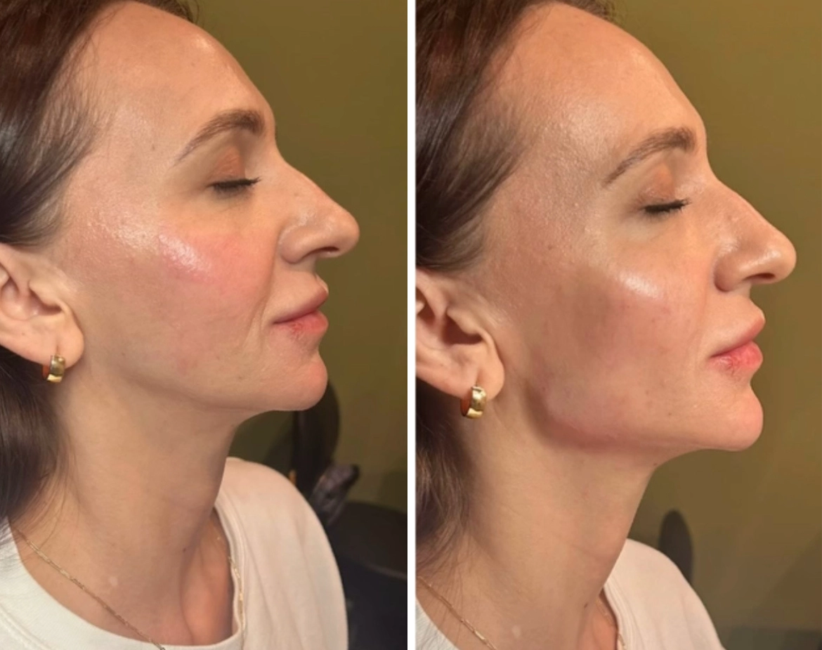 EliteJawline-JeffGoldstein-six.webp