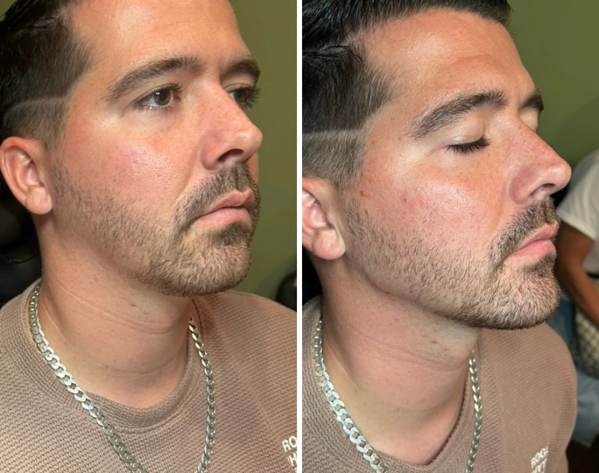 EliteJawline-JeffGoldstein-three.webp