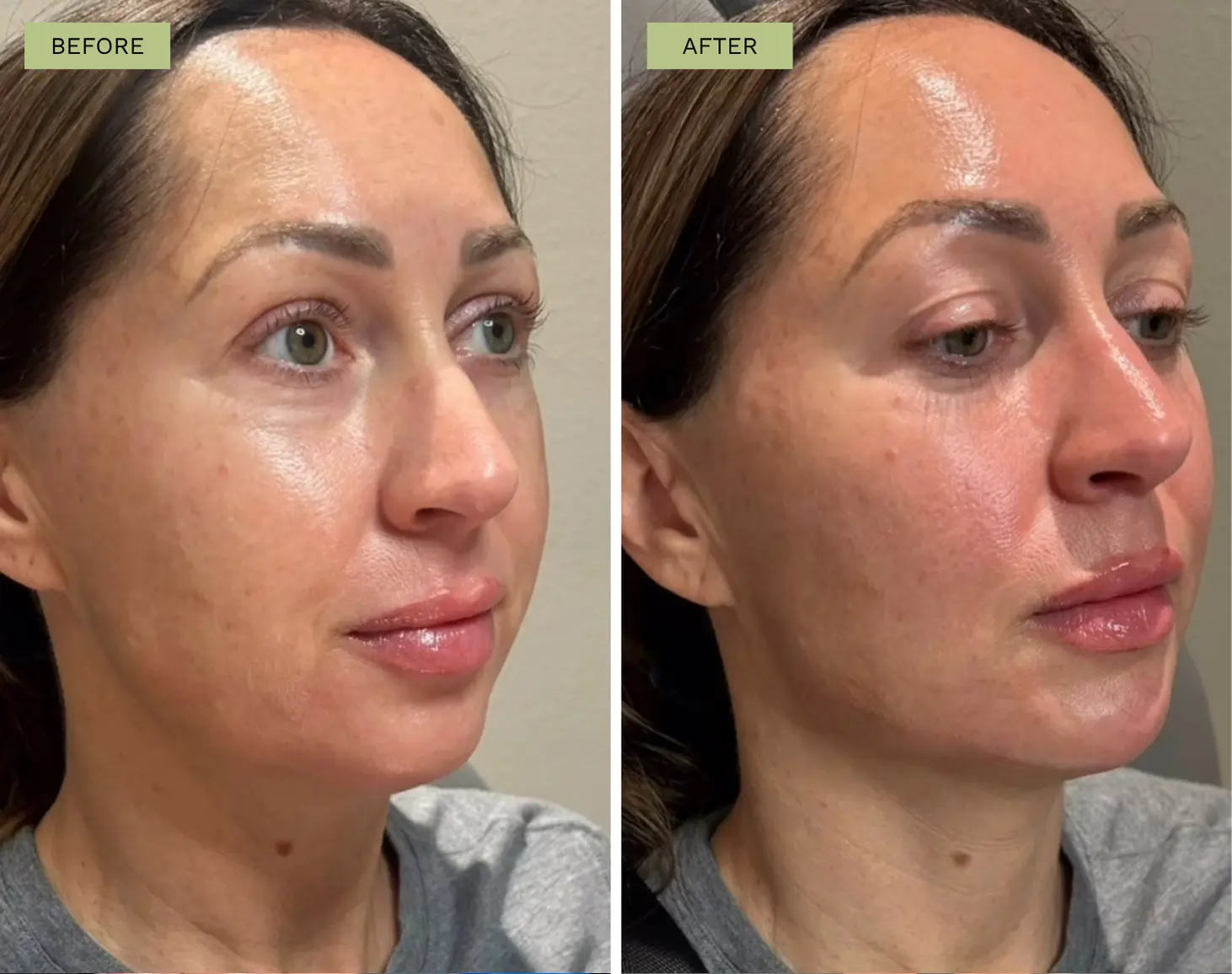 Elite Facial Balancing - Jeff Goldstein, PA-C