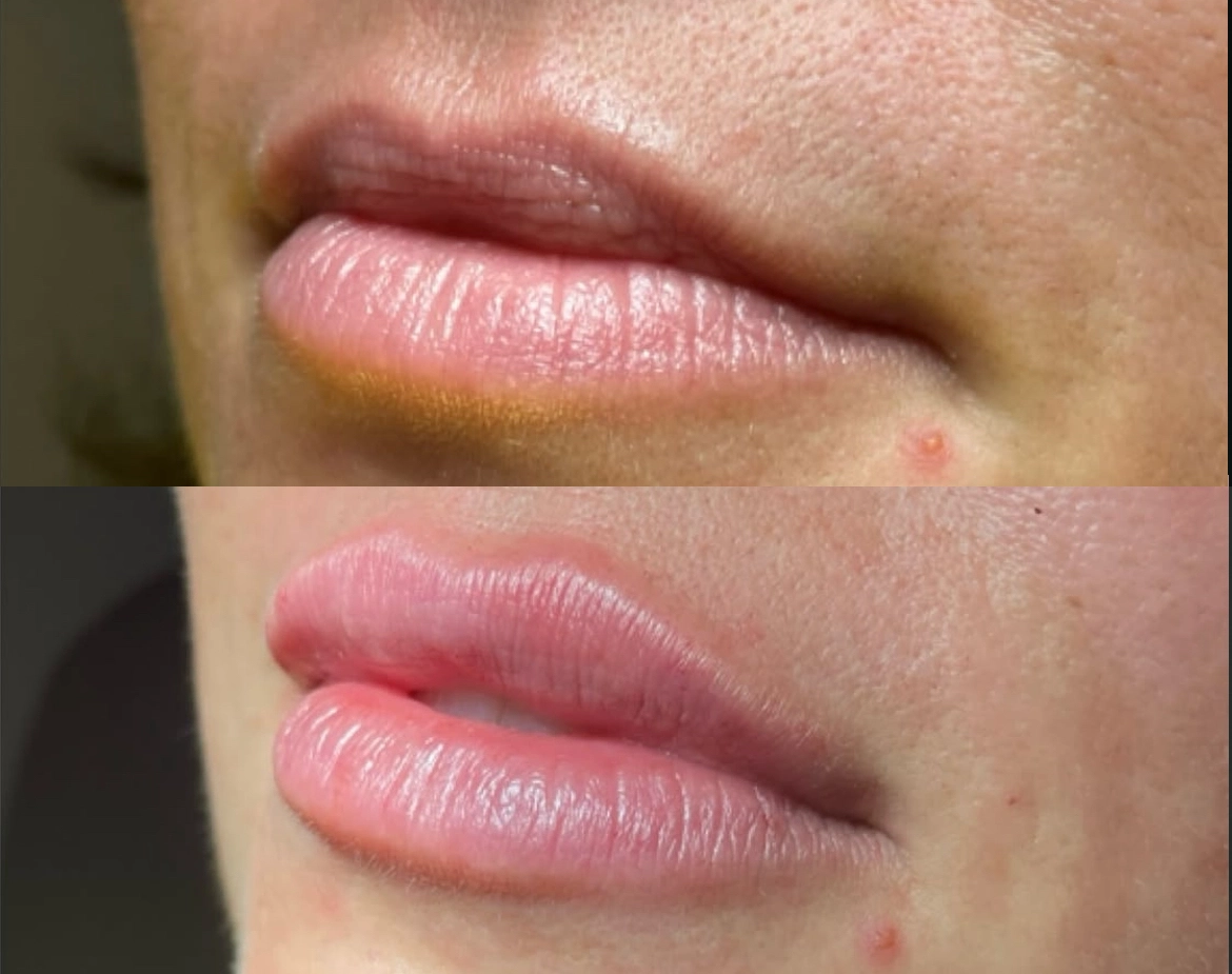 lips-fivvee.webp