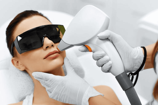Woman wearing protective eyewear during a laser hair removal treatment targeting unwanted hair on her upper lip.